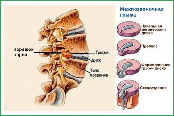 Что будет, если не продлить больничный в назначенный день?