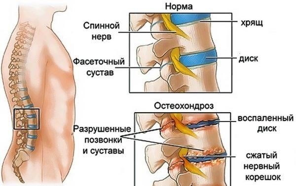 Срок больничного листа